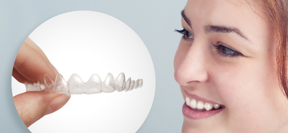 Invisalign